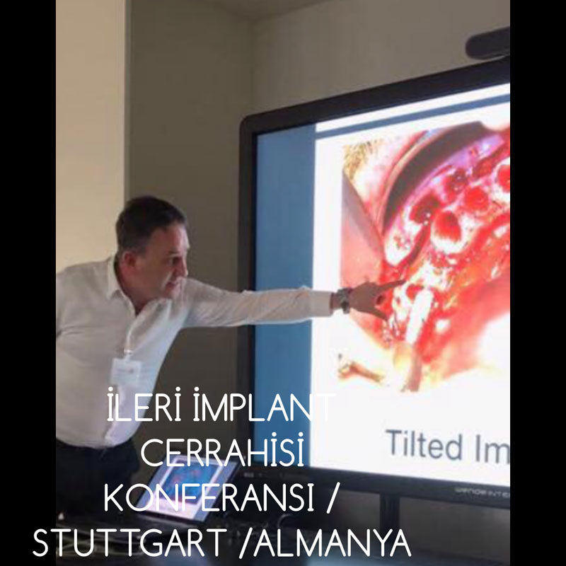 Diş Eti Uzmanı