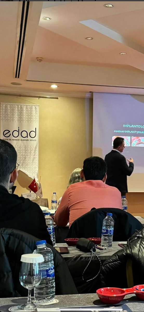 Diş İmplantı Fiyatları Ne Kadar?