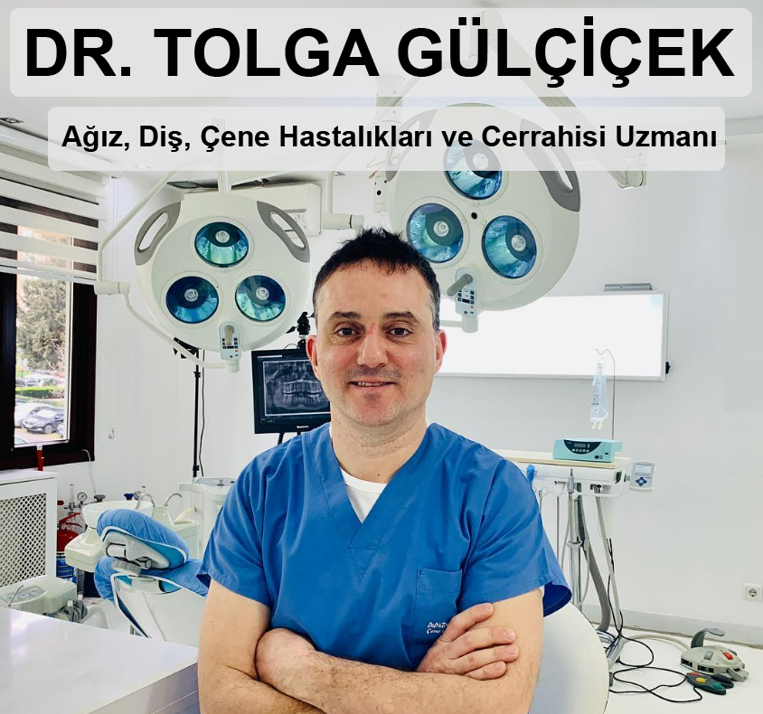 İmplant Çeşitleri Nelerdir?