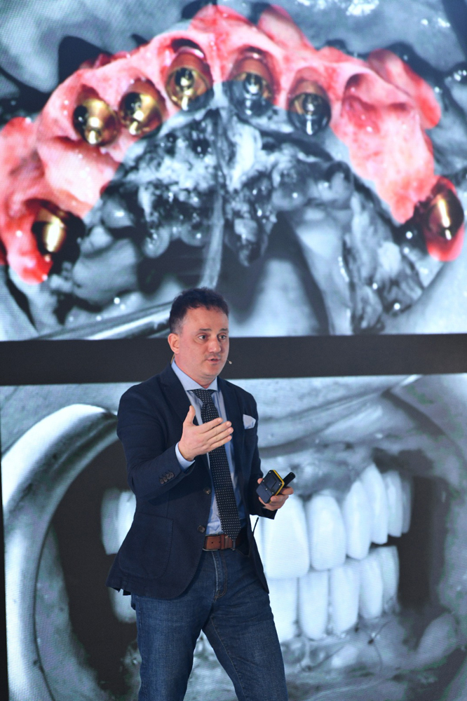 İmplant Markaları Önemli midir?