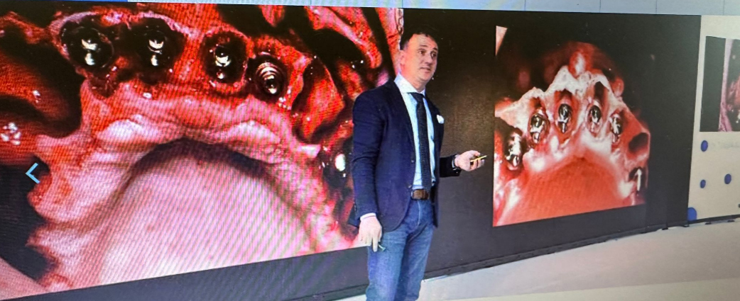İstanbul'da İmplant Yapan Doktorlar