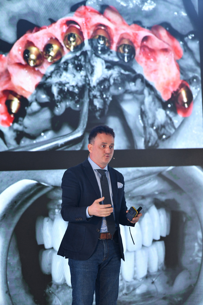 Protez Diş Ücretleri